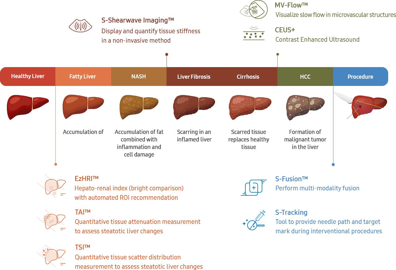 liveraanlysissolution-2022-samsung-healthcare-global