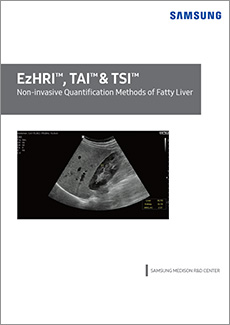 Leaflet about fatty liver ultrasound