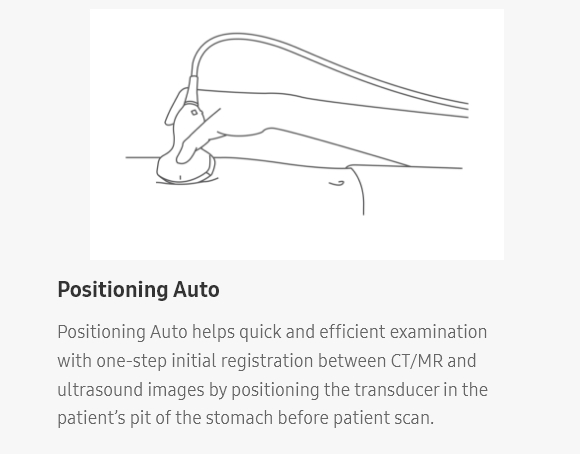 Positioning Auto, Positioning Auto helps quick and efficient examination with one-step initial registration between CT/MR and ultrasound images by positioning the transducer in the patient’s pit of the stomach before patient scan.