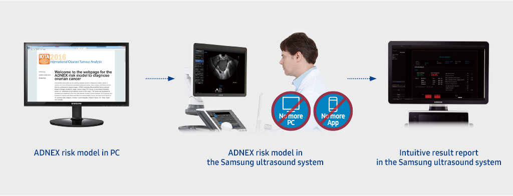ADNEX risk model in PC/ADNEX risk model in the Samsung ultrasound system/Intuitive result report in the Samsung ultrasound system