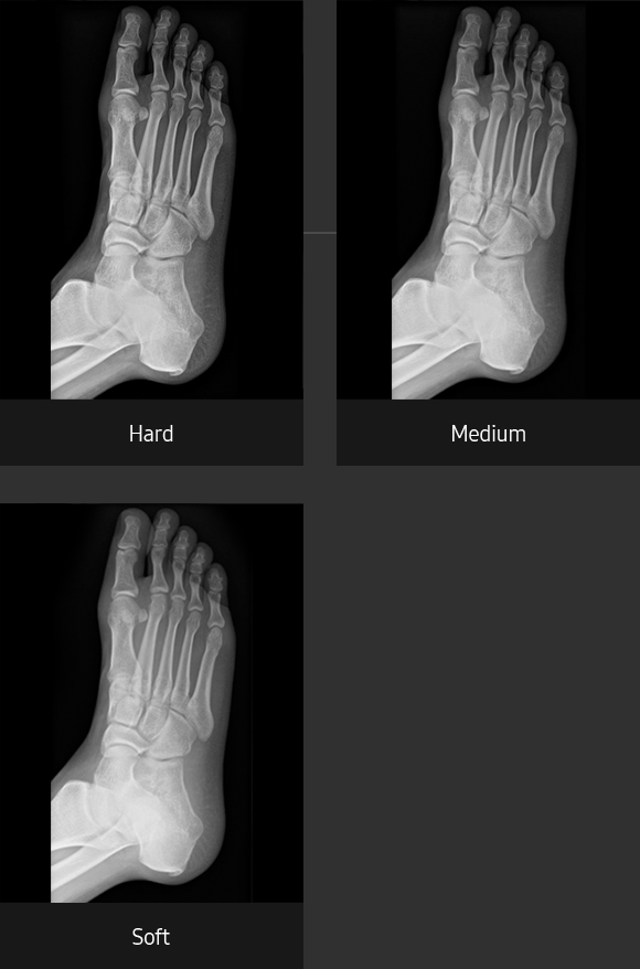 Foot oblique Sample