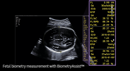 medical diagnostics : BiometryAssist™