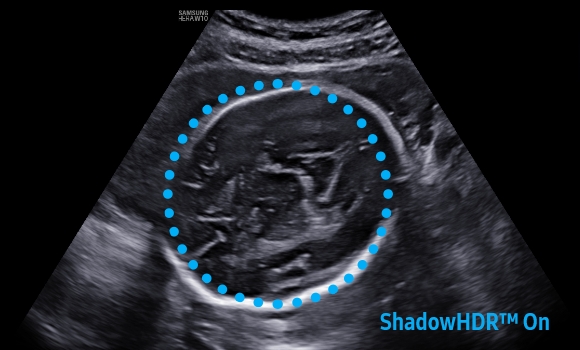 imaging solutions of 2d images : ShadowHDR™ - on