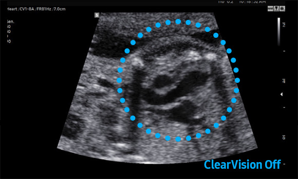 powerful imaging : ClearVision - off