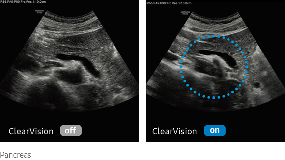 imaging solutions : ClearVison