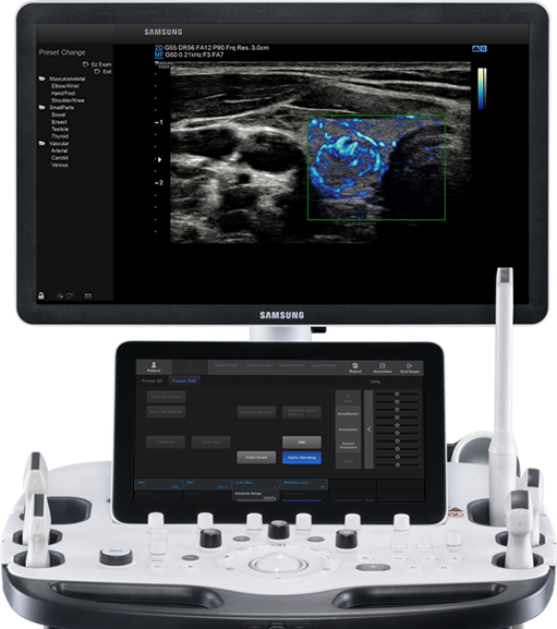 ultrasound images : MV-Flow™