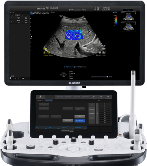 ultrasound images : S-Shearwave Imaging™