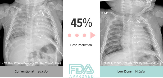 45% Dose Reduction