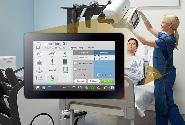 Touchdisplay im Vordergrund, im Hintergrund bedient eine MTA/MTRA das digitale  Röntgensystem GM85 von Samsung und erstellt eine Aufnahme an einem Patienten.
