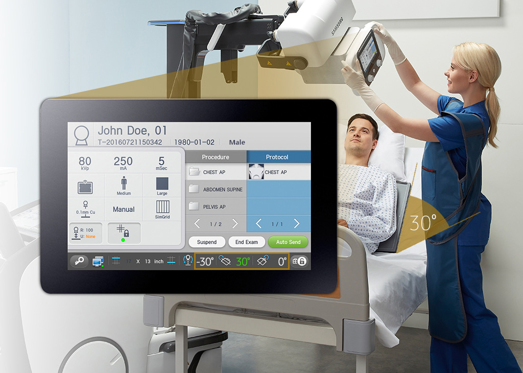 Touchdisplay im Vordergrund, im Hintergrund bedient eine MTA/MTRA das digitale  Röntgensystem GM85 von Samsung und erstellt eine Aufnahme an einem Patienten.