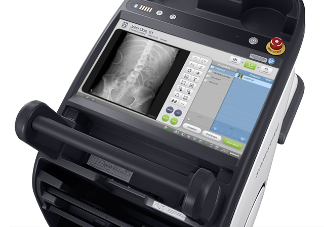 Digitales Röntgensystem GM85 von Samsung mit Röntgenbild von Wirbelsäule.