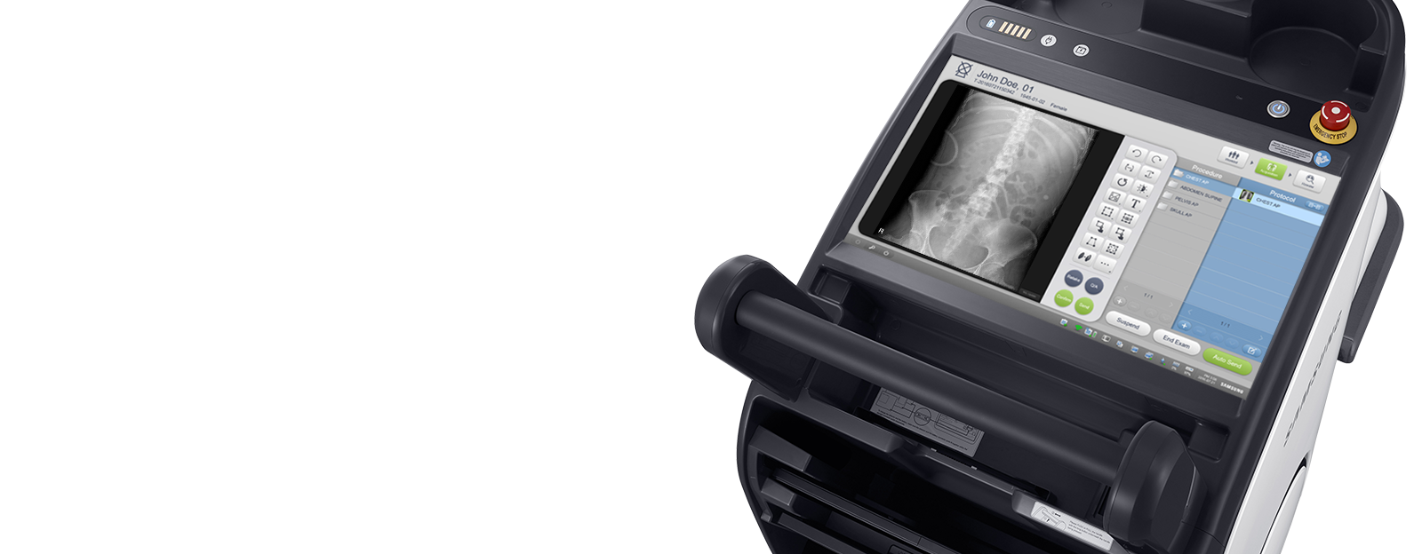 Digitales Röntgensystem GM85 von Samsung mit Röntgenbild von Wirbelsäule.