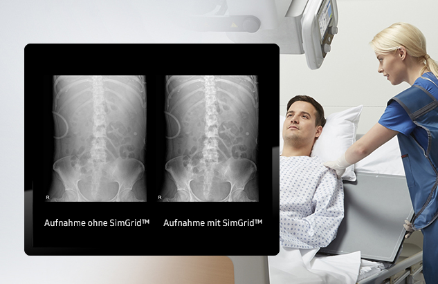 Zwei Röntgenaufnahmen von Wirbelsäule im Vordergrund, mit Patient und digitalem Röntgensystem GM85 von Samsung im Hintergrund.