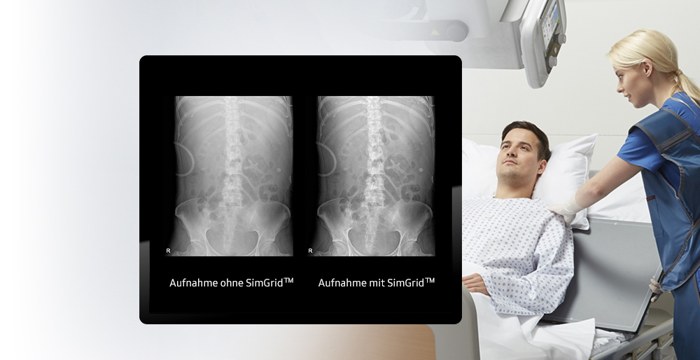 Zwei Röntgenaufnahmen von Wirbelsäule im Vordergrund, mit Patient und digitalem Röntgensystem GM85 von Samsung im Hintergrund.