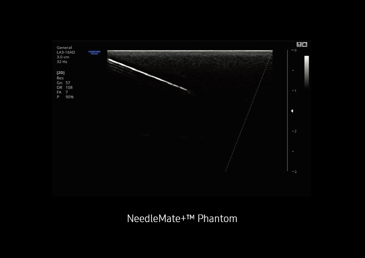 Ultraschallbild mit NeedleMate Funktion von Samsung.