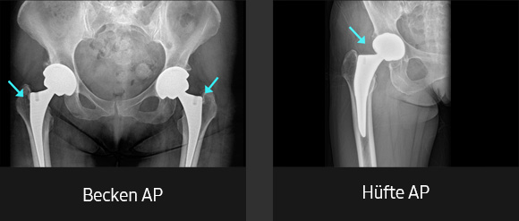 Röntgenbilder (Becken, Becken AP, Hüfte AP) aufgenommen mit digitalem Röntgengerät von Samsung.