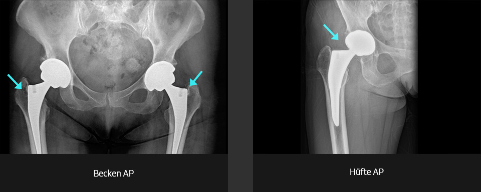 Röntgenbilder (Becken, Becken AP, Hüfte AP) aufgenommen mit digitalem Röntgengerät von Samsung.