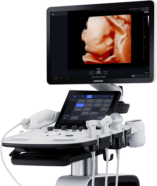 Samsung-HS40A-echographie-gynecologie-obstetrique-realistic-vue