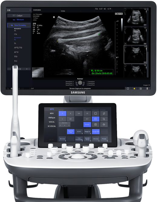 Samsung-HS50A-ultrasons-gynecologie-obstetrique-realistic-vue