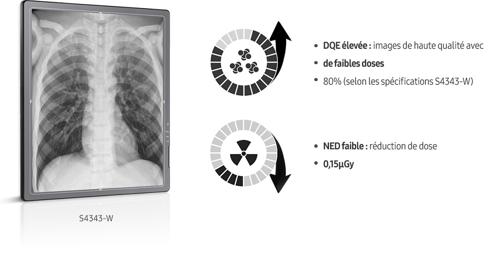 S-detector-radiographie-benefices-images claires-DQE-elevee