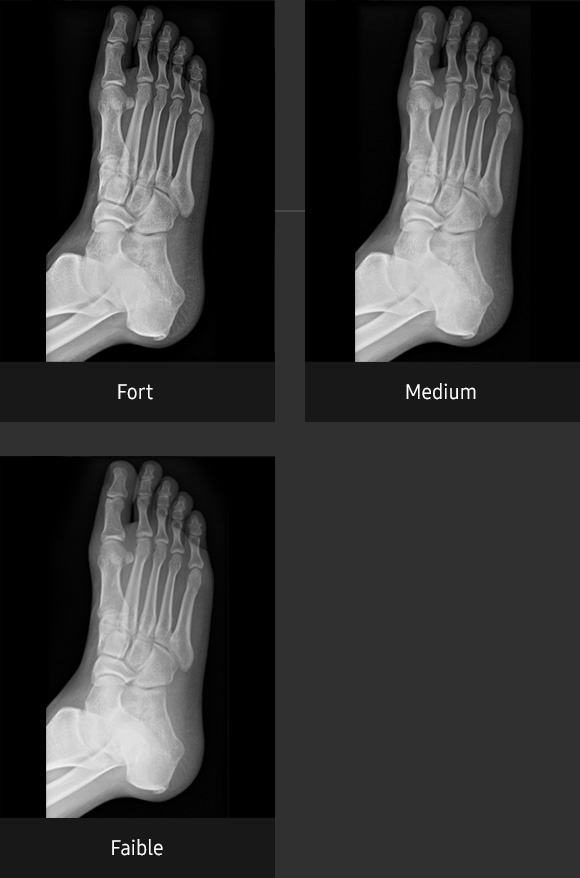 S-Vue-radiographie-benefices-ajustement-contraste-pied