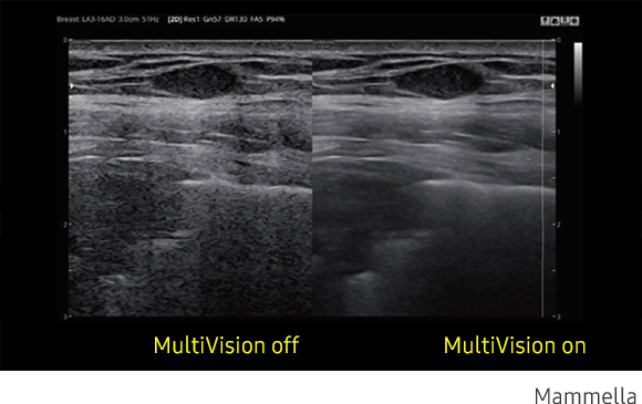 Immagine clinica della mammella ottenuta con software MultiVision