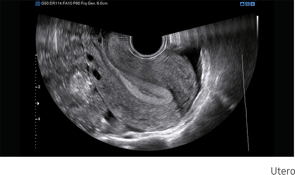 Vista delle 4 camere del cuore fetale