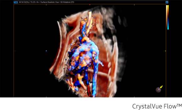 Immagine clinica della colonna vertebrale fetale ottenuta con software Crystal Vue Flow™