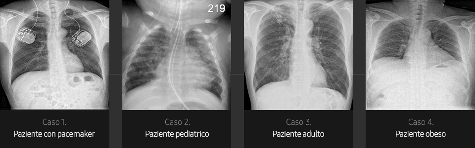 Immagini radiografiche in diverse condizioni di esame
