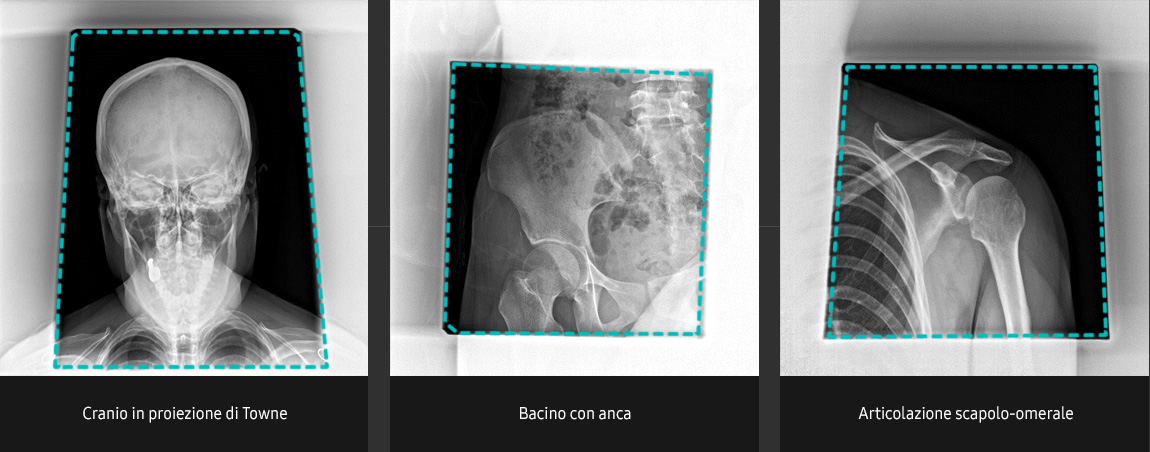 Immagini radiografiche in diverse condizioni di esame