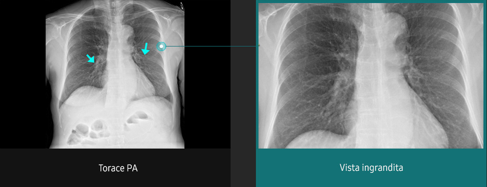 Immagini radiografiche in diverse condizioni di esame con elevata definizione e chiarezza