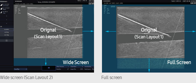 WideScreen, FullScreen