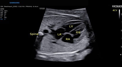 ob gyn ultrasound machine tech : ViewAssist™