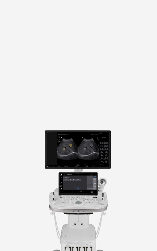 Front view of the R20 ultrasound system for general imaging with dual monitors, a large display screen and a secondary touchscreen control panel, and multiple transducer ports