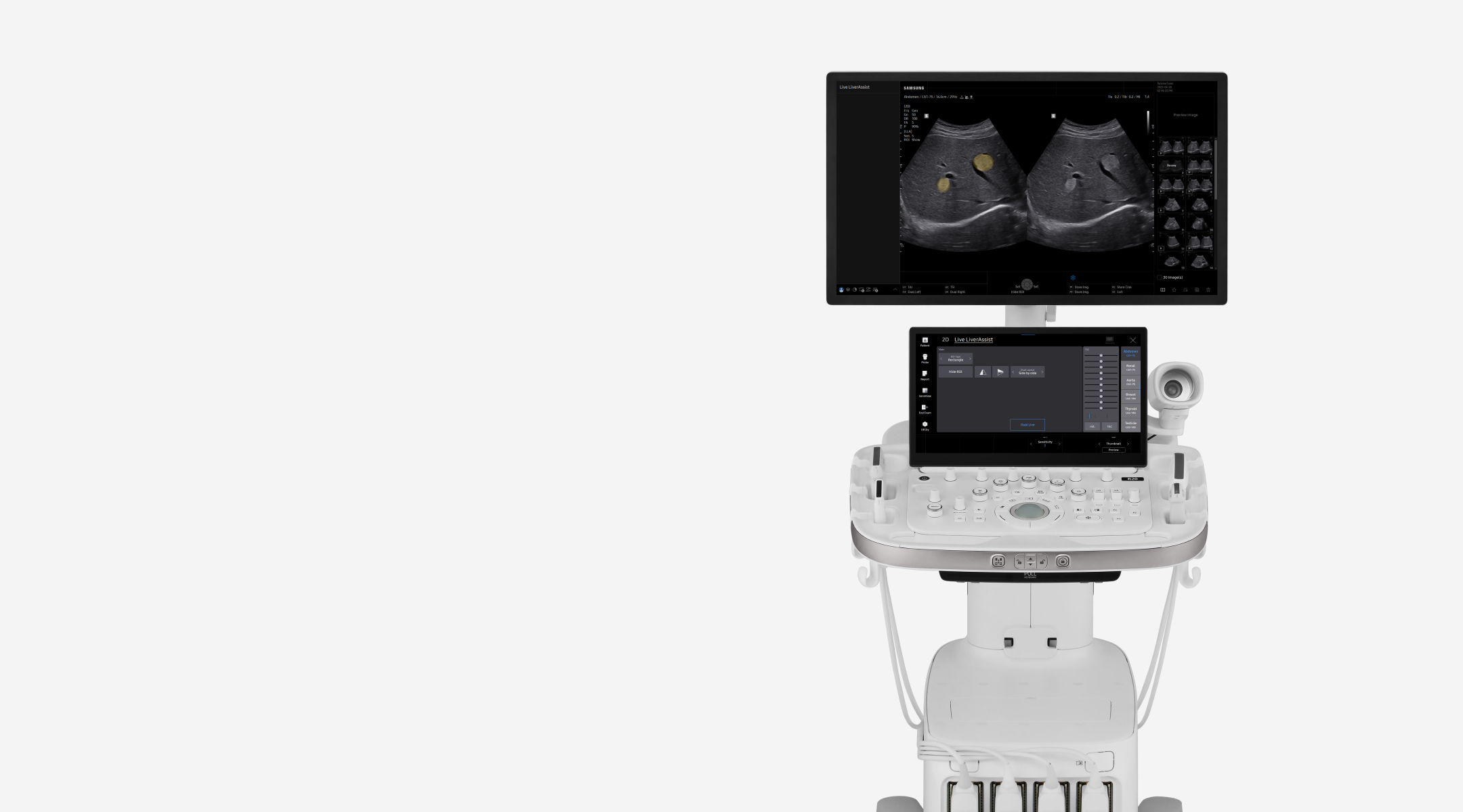 Front view of the R20 ultrasound system for general imaging with dual monitors, a large display screen and a secondary touchscreen control panel, and multiple transducer ports