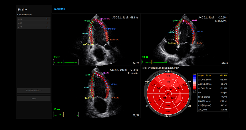 Advanced Strain+ LV cardiac analysis on Samsung's diagnostic display showing multi-view heart chamber assessment with color-coded ventricular wall tracking and comprehensive bull's-eye plot visualization