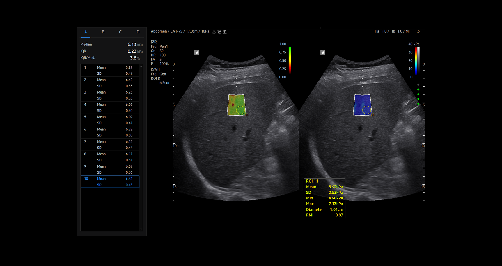 Dual-panel abdominal ultrasound image of the liver using S-Shearwave Imaging showing two regions of interest (ROI) overlaid with color-coded elastography maps in green red and blue indicating tissue stiffness levels with detailed quantitative measurements including mean standard deviation minimum maximum stiffness values diameter and RMI displayed on the screen