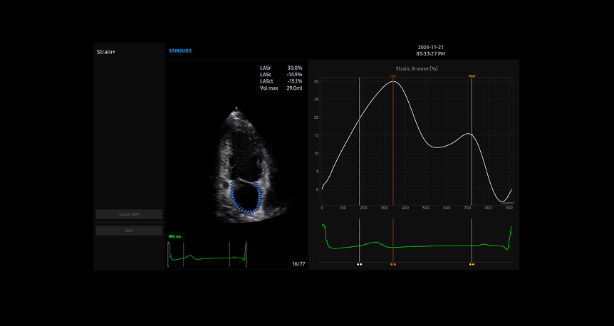 Samsung cV Ultrasound Strain+ technology displaying quantitative analysis of myocardial function with color-coded segmental wall motion visualization and corresponding strain measurement graph for comprehensive cardiovascular assessment