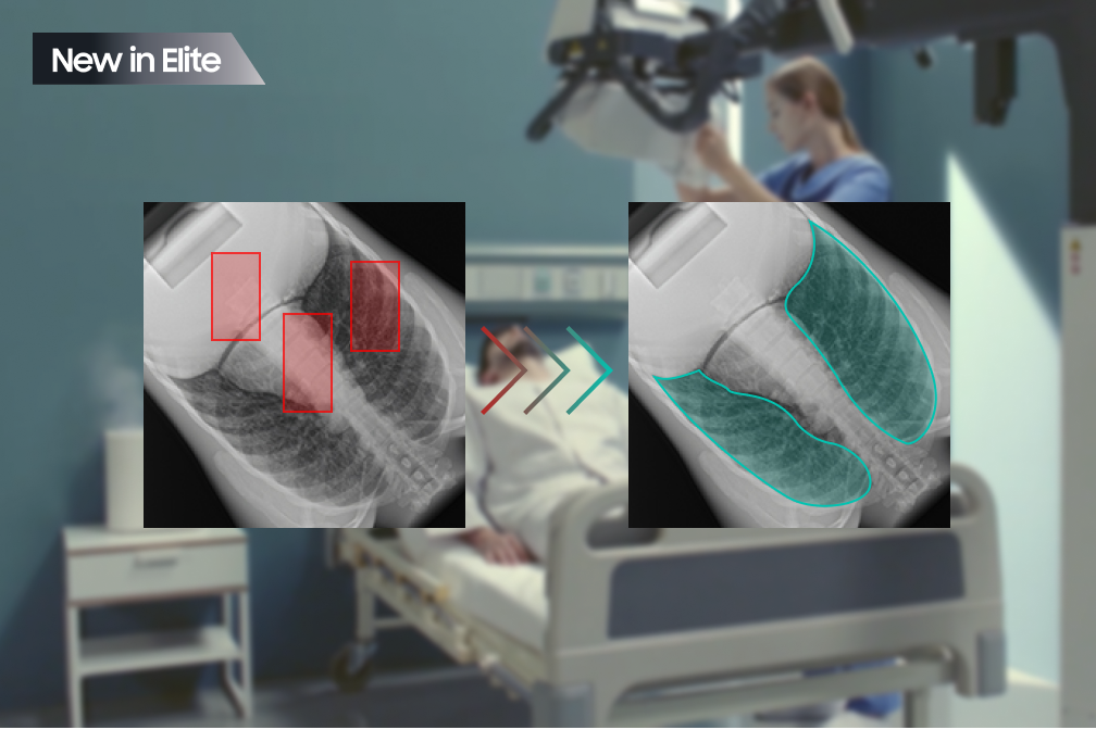 S-AEC (Smart Auto Exposure Control) technology showing X-ray images with highlighted detection areas and radiation dose control based on patient size.